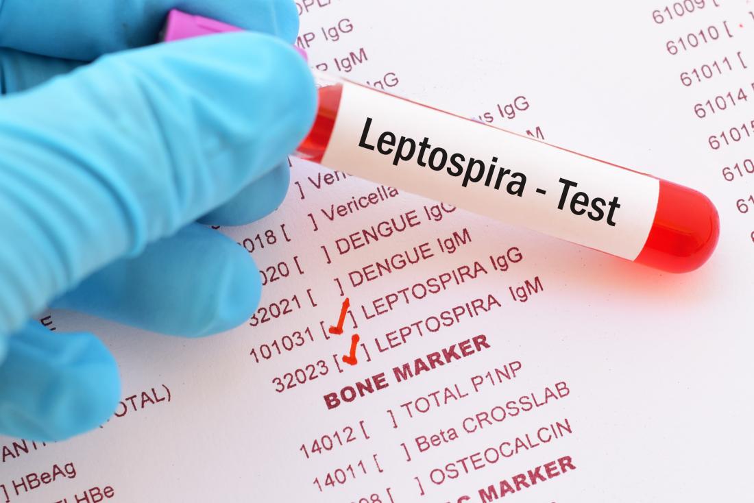 Leptospirosis: Strategi Efektif Untuk Edukasi Dan Kesadaran Masyarakat
