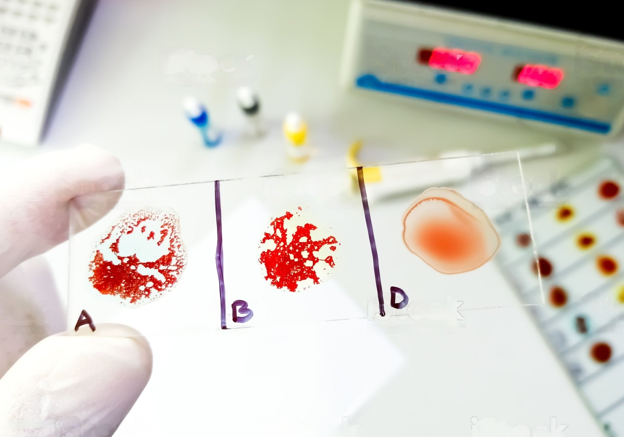 Gambar ilustratif tangan seorang dokter memegang tabung sampel darah dengan label yang menunjukkan berbagai golongan darah, digunakan untuk menentukan jenis darah pasien dalam konteks medis